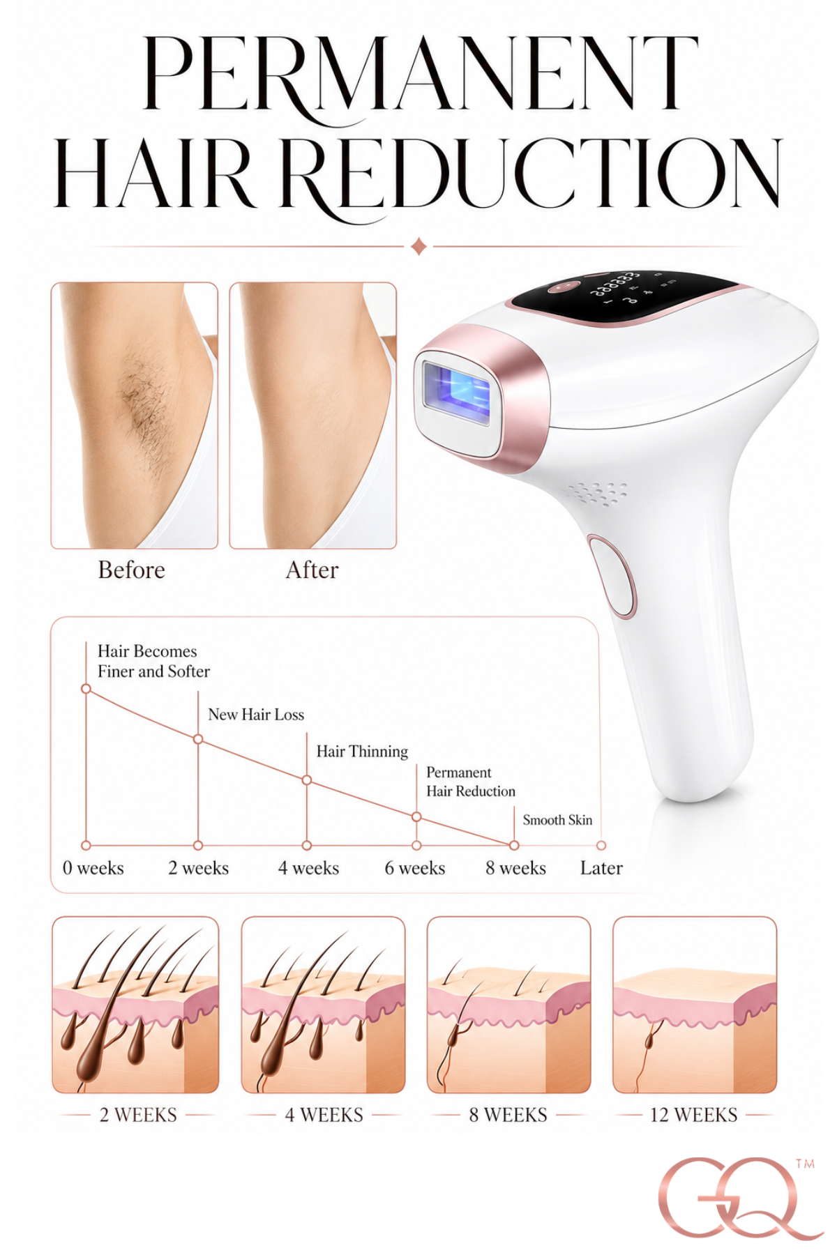 Luce Seta Cooling IPL Hair Removal Device | GLOWNIQUE